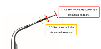 Shank anatomy shank anatomy